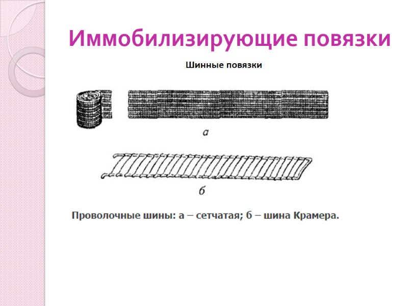 Иммобилизирующие повязки Шинные повязки
